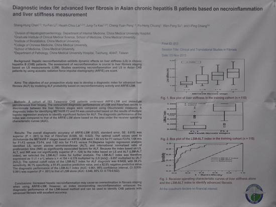 [AASLD2013]基于坏死炎症和肝脏硬度检测的亚洲慢性乙型肝炎患者重度肝纤维化的诊断指数