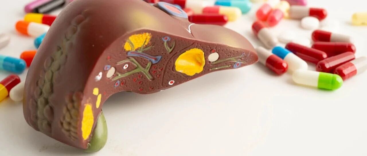 Hepatology丨肝癌系统治疗的疗效评估：如何破局迈向精准评估的新时代？