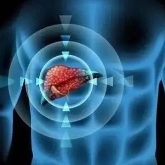 APASL聚焦丨循环miR-122水平可预测HCC经动脉化疗栓塞术后的总生存